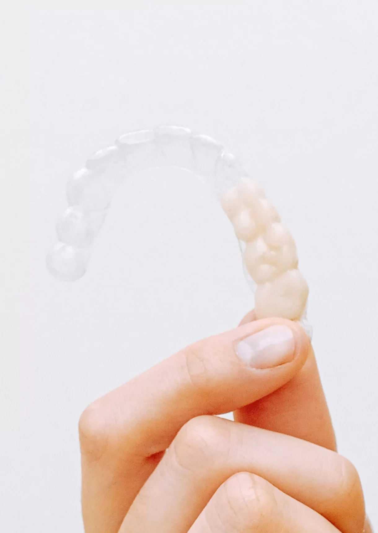Invisalign Cost in South Africa: 7 Factors Behind Your Quote 3 Invisalign cost consultation and clear aligner treatment planning